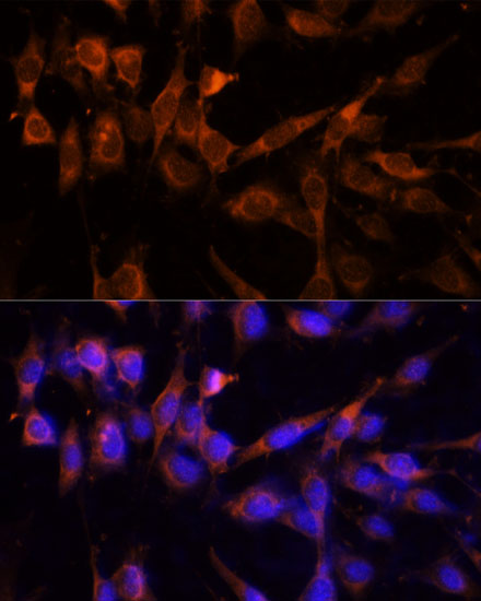 Anti-YWHAH Polyclonal Antibody (CAB9079)