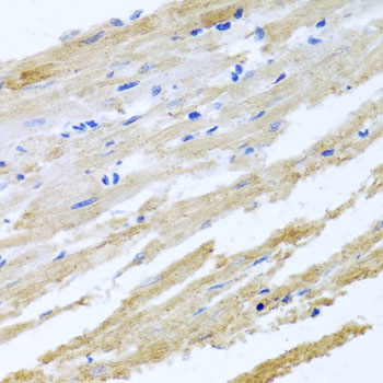 Anti-BNIP3 Antibody (CAB5683)