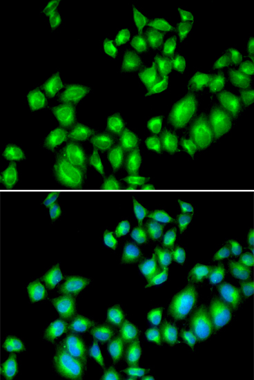 Anti-DRD3 Antibody (CAB1556)