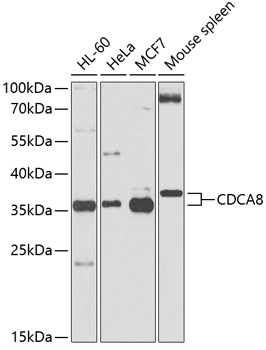 Anti-CDCA8 Antibody (CAB0675)