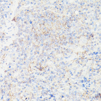 Anti-IGFBP1 Antibody (CAB11109)