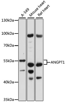 Anti-ANGPT1 Antibody (CAB15026)