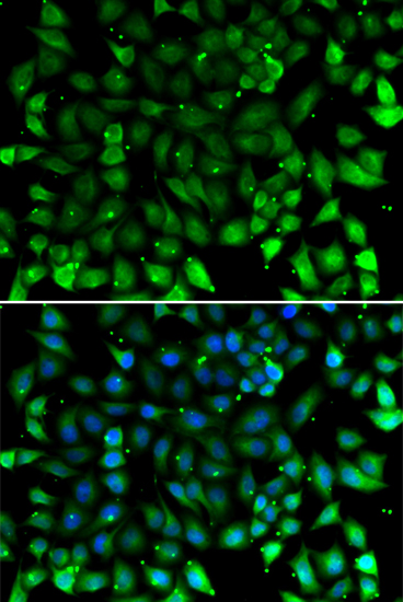 Anti-CCL26 Antibody (CAB11980)