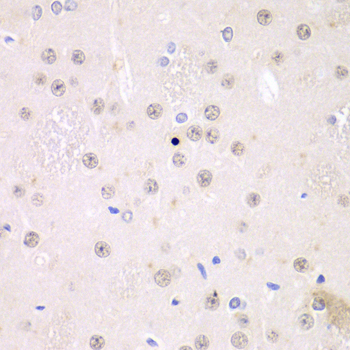 Anti-FMR1 Antibody (CAB5645)