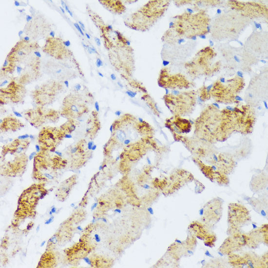 Anti-WSB2 Antibody (CAB12970)