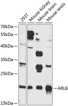 Anti-ARL6 Polyclonal Antibody (CAB8269)