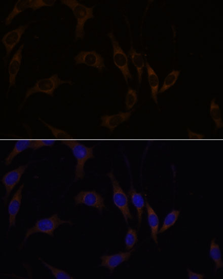 Anti-RGS4 Antibody (CAB1787)