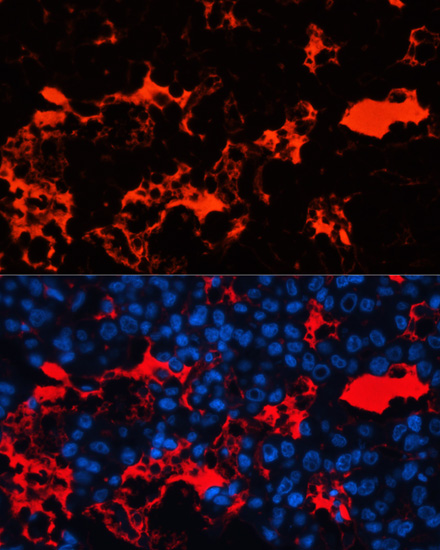 Anti-Albumin Antibody (CAB1363)