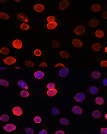 Anti-SUN2 Antibody (CAB16325)