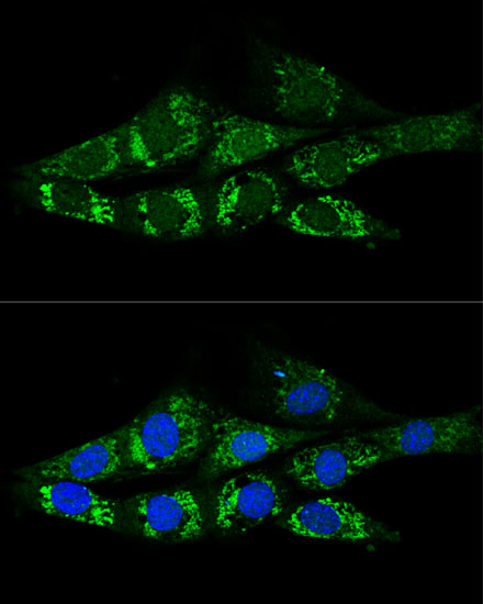 Anti-ACSS2 Antibody (CAB6472)