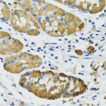 Anti-PLA2G2D Antibody (CAB6690)