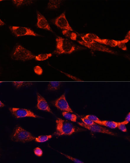 Anti-SELL Antibody (CAB1622)