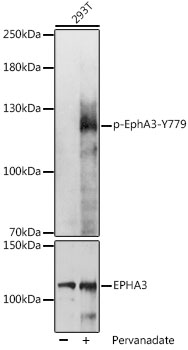 Anti-Phospho-EphA3-Y779 Antibody (CABP1056)