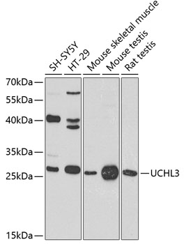 Anti-UCHL3 Polyclonal Antibody (CAB8156)