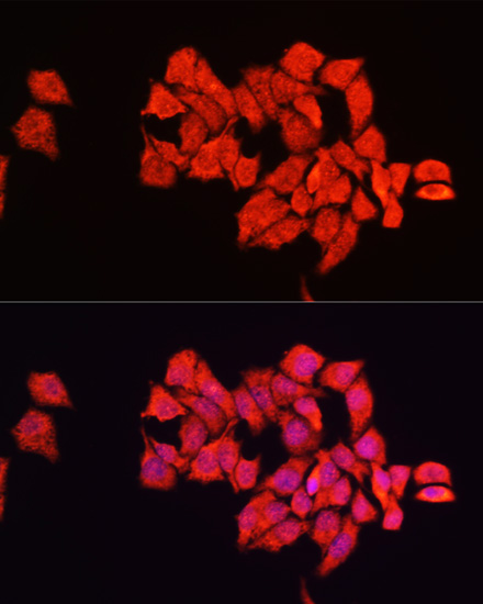 Anti-ALDH2 Antibody (CAB13463)