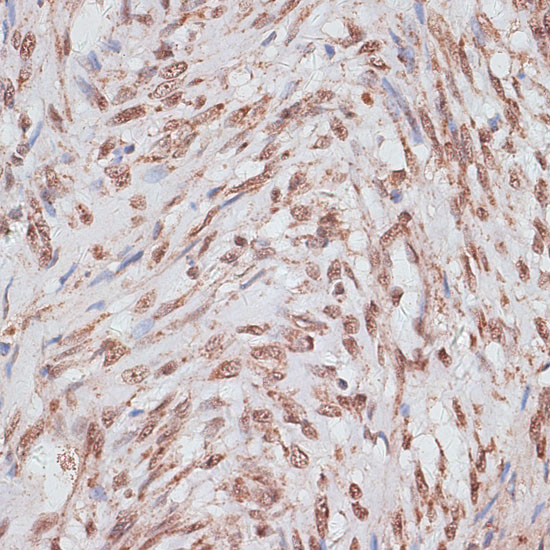 Anti-RPA1 Antibody (CAB0874)