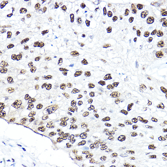 Anti-NBN Antibody [KO Validated] (CAB0783)