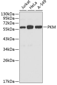 Anti-PKM Antibody (CAB0268)