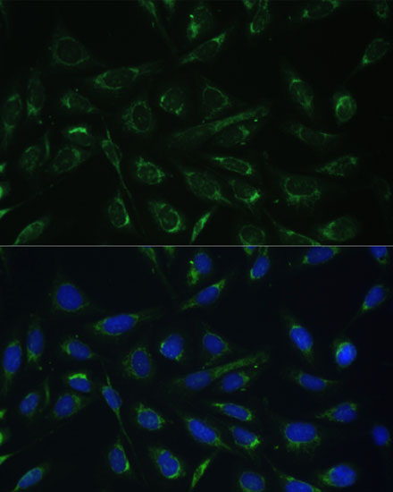 Anti-HCCS Antibody (CAB7490)