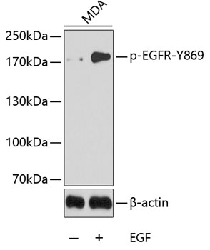 Anti-Phospho-EGFR-Y869 Antibody (CABP0224)