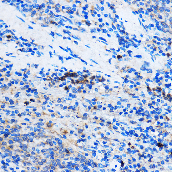 Anti-Chk1 Antibody (CAB7653)