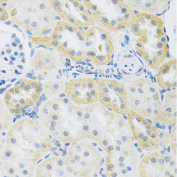 Anti-SLC39A7 Antibody (CAB3343)