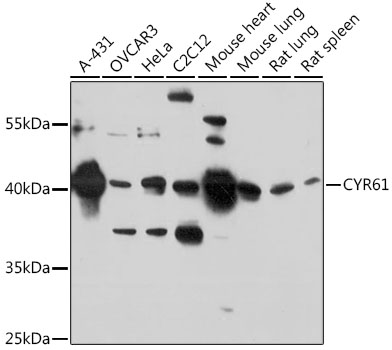 Anti-CYR61 Antibody (CAB1111)