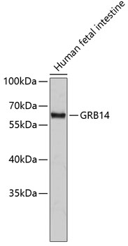 Anti-GRB14 Antibody (CAB2742)