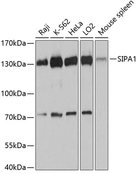 Anti-SIPA1 Antibody (CAB12253)