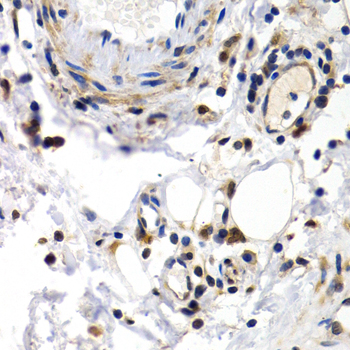 Anti-PKLR Antibody (CAB1924)