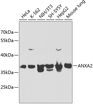 Anti-ANXA2 Antibody [KO Validated] (CAB1572)