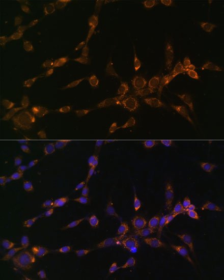 Anti-MTCO1 Antibody (CAB17889)