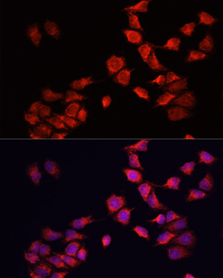 Anti-BNIP3 Antibody (CAB5683)