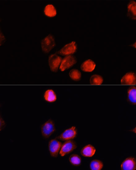 Anti-TYR Antibody (CAB13608)