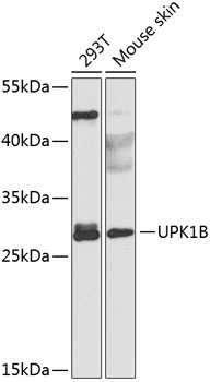 Anti-Uroplakin-1b Polyclonal Antibody (CAB8157)