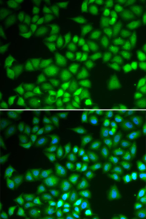 Anti-NFKB1 Antibody [KO Validated] (CAB6667)