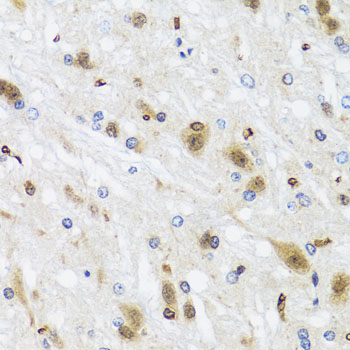 Anti-HDAC4 Antibody (CAB0179)