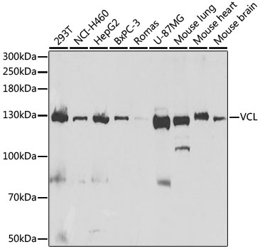 Anti-VCL Antibody (CAB14193)