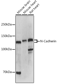 Anti-N-Cadherin Antibody [KO Validated] (CAB0432)