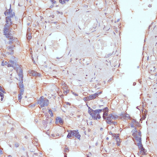 Anti-ARL4D Antibody (CAB16761)