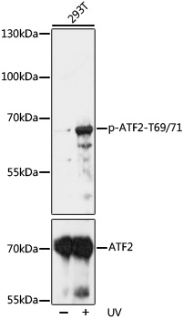 Anti-Phospho-ATF2-T69/71 Antibody (CABP0913)