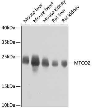 Anti-MTCO2 Antibody (CAB11154)