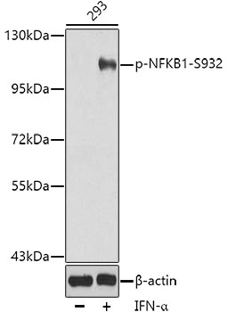 Anti-Phospho-NFKB1-S932 Antibody (CABP0417)