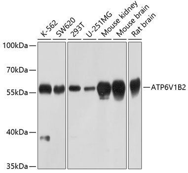 Anti-ATP6V1B2 Antibody (CAB3754)