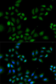 Anti-PRDX1 Antibody (CAB13524)