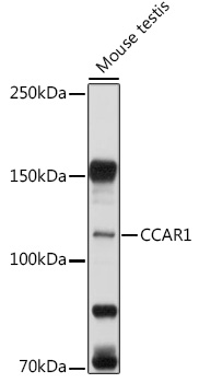 Anti-CCAR1 Antibody (CAB6334)