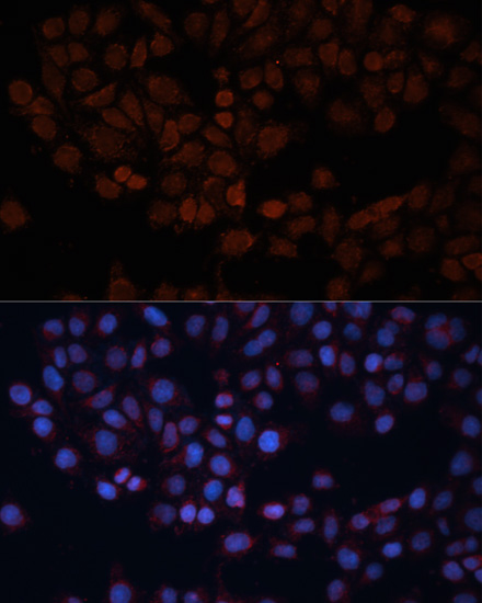 Anti-TOM70 Antibody (CAB4349)