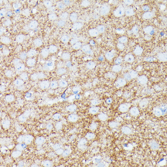 Anti-SNCG Antibody (CAB14492)