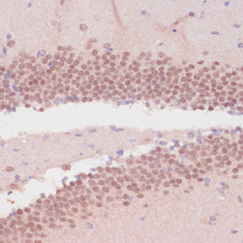 Anti-RXRG Antibody (CAB1877)