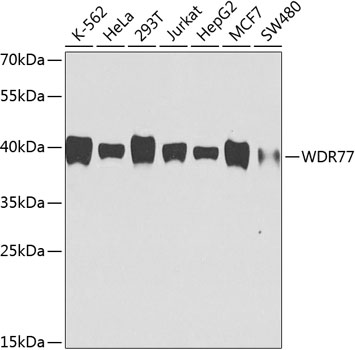 Anti-WDR77 Monoclonal Antibody (CAB9921)